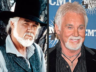 Kenny Rogers: Before & AfterCelebrity Plastic Surgery Nightmare 