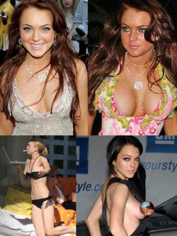 Lindsay LohanCelebrity Plastic Surgery  