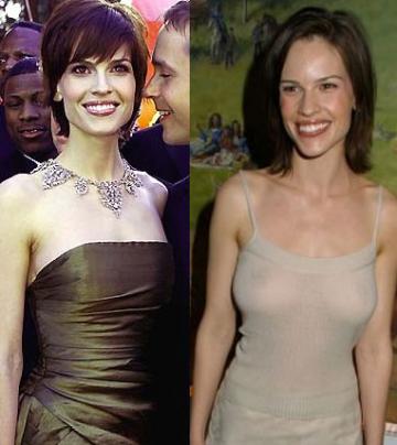 Hilary SwankCelebrity Plastic Surgery 