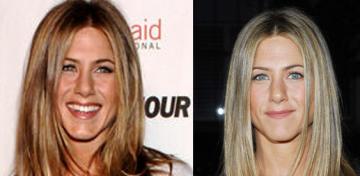 Jennifer Aniston: Before & After