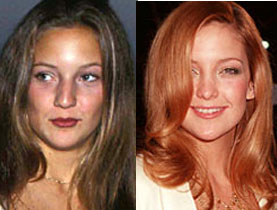 Kate Hudson: Before & After