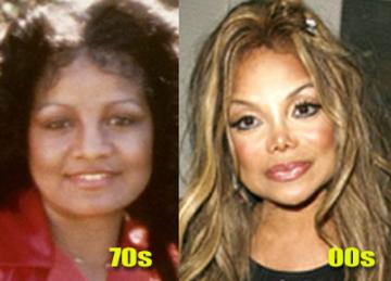 Latoya Jackson:: Before & After