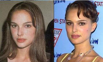 Natalie Portman: Before & After