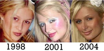 Paris Hilton: : Before & After