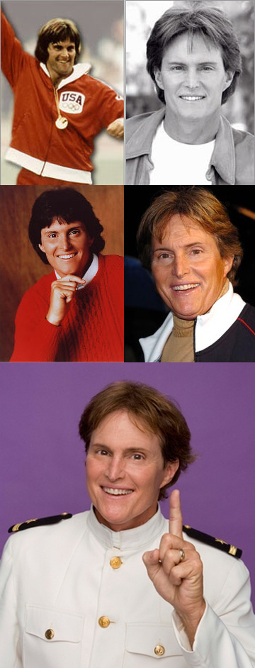 Bad Celebrity Plastic Surgery: Bruce Jenner Awful Plastic Surgery 