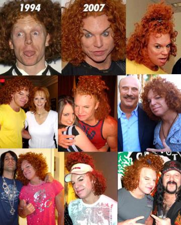 Bad Celebrity Plastic Surgery: Carrot Top Awful Plastic Surgery 