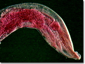 Mature female pinworm