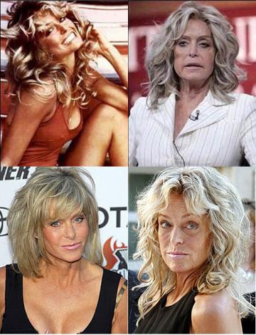 Bad Celebrity Plastic Surgery: Farrah Fawcett Awful Plastic Surgery 