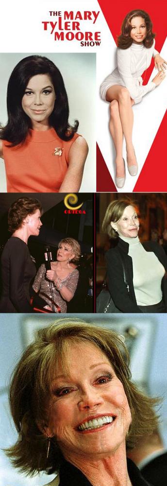 Bad Celebrity Plastic Surgery: Mary Tyler Moore Awful Plastic Surgery 
