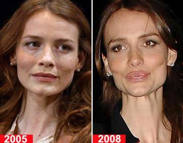 Saffron Burrows Before and After