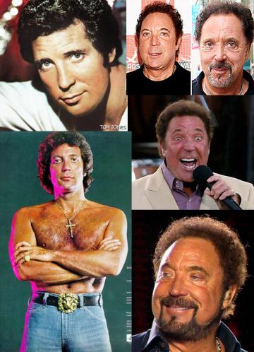 Bad Celebrity Plastic Surgery: Tom Jones Awful Plastic Surgery 